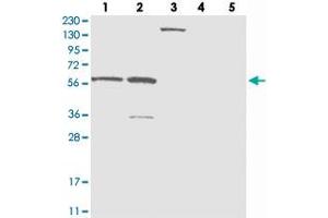 Western blot analysis of Lane 1: RT-4, Lane 2: U-251 MG, Lane 3: Human Plasma, Lane 4: Liver, Lane 5: Tonsil with ZNF250 polyclonal antibody  at 1:250-1:500 dilution.