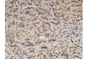 Immunoperoxidase of monoclonal antibody to DDB1 on formalin-fixed paraffin-embedded human adrenal gland. (DDB1 Antikörper  (AA 1044-1140))