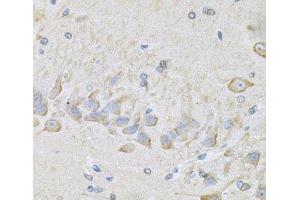 Immunohistochemistry of paraffin-embedded Mouse brain using RhoA Polyclonal Antibody at dilution of 1:100 (40x lens). (RHOA Antikörper)