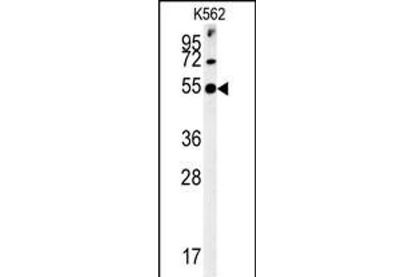 SYT13 Antikörper  (N-Term)