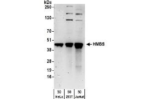 Western Blotting (WB) image for anti-Hydroxymethylbilane Synthase (HMBS) (AA 311-361) antibody (ABIN7450329)