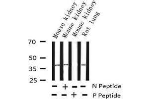 Western blot analysis of Phospho-c-Jun (Ser73) expression in various lysates (C-JUN Antikörper  (pSer73))