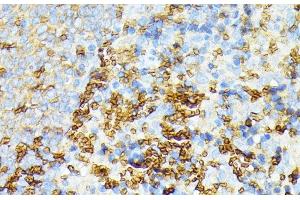 Immunohistochemistry of paraffin-embedded Rat spleen using SPTA1 Polyclonal Antibody at dilution of 1:100 (40x lens). (SPTA1 Antikörper)