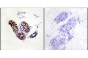 Immunohistochemistry (IHC) image for anti-Microphthalmia-Associated Transcription Factor (MITF) (AA 151-200) antibody (ABIN2888676) (MITF Antikörper  (AA 151-200))