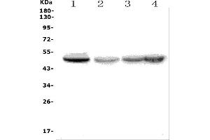 Western blot analysis of ETF1 using anti-ETF1 antibody (ABIN7602624).