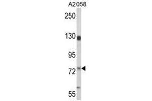 Western blot analysis of MCAM Antibody (MCAM Antikörper  (Middle Region))