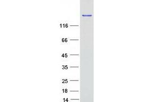 Western Blotting (WB) image for Fatty Acid Synthase (FASN) protein (Myc-DYKDDDDK Tag) (ABIN2720912)