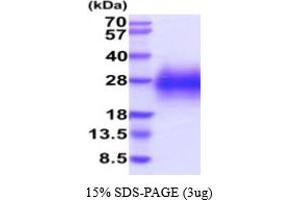 SDS-PAGE (SDS) image for Glycophorin C (GYPC) (AA 1-57) protein (His tag) (ABIN5854842) (CD236/GYPC Protein (AA 1-57) (His tag))