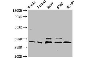 Western Blot Positive WB detected in: HepG2 whole cell lysate, Jurkat whole cell lysate, 293T whole cell lysate, K562 whole cell lysate, HL-60 whole cell lysate All lanes: GEMIN2 antibody at 3. (SIP1 Antikörper  (AA 1-280))