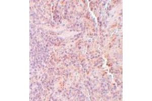 Immunohistochemistry (IHC) image for anti-Sequestosome 1 (SQSTM1) (C-Term) antibody (ABIN1030699) (SQSTM1 Antikörper  (C-Term))