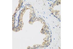 Immunohistochemistry of paraffin-embedded human prostate using NCBP2 antibody (ABIN5974395) at dilution of 1/200 (40x lens). (NCBP2 Antikörper)