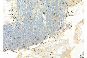 ABIN6263648 and ABIN6266600 at 1/100 staining Rat brain tissue by IHC-P. (NKX3-1 Antikörper  (Internal Region))