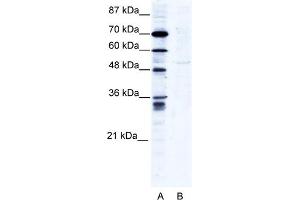 WB Suggested Anti-ZNF134 Antibody Titration:  2. (ZNF134 Antikörper  (N-Term))