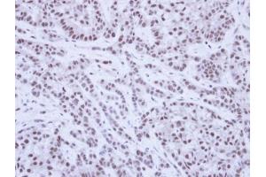 IHC-P Image Immunohistochemical analysis of paraffin-embedded A549 Xenograft, using SAE1, antibody at 1:100 dilution.