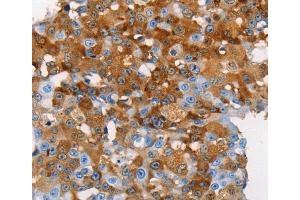 Immunohistochemistry (IHC) image for anti-Mucin 5 Subtype B (MUC5B) antibody (ABIN2432112) (MUC5B Antikörper)