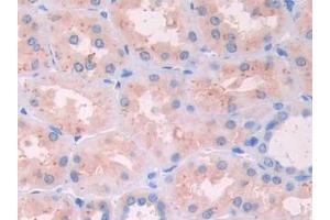 Used in DAB staining on fromalin fixed paraffin- embedded stomach cancer tissue (RNASE12 Antikörper  (AA 21-147))