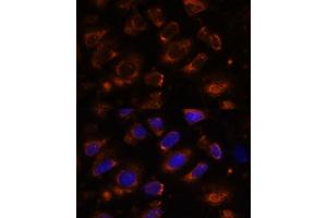 Immunofluorescence analysis of U-2 OS cells using TENM1 antibody (ABIN7270767) at dilution of 1:100.