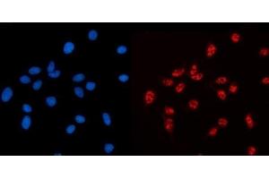 IF analysis of AKAP 95/AKAP8 using anti-AKAP 95/AKAP8 antibody (ABIN7601553). (AKAP8 Antikörper  (AA 380-546))