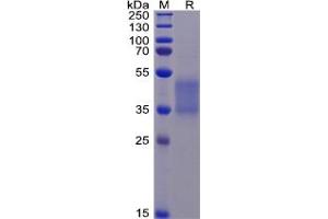 Human FCGR3A Protein(F176V), His Tag on SDS-PAGE under reducing condition. (FCGR3A Protein (His tag))