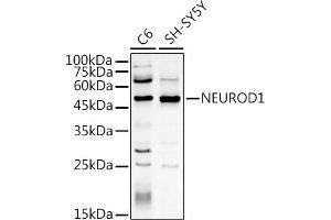 Western blot analysis of extracts of various cell lines, using NEUROD1 antibody (ABIN3021547, ABIN3021548, ABIN3021549, ABIN1513255 and ABIN6215228) at 1:500 dilution. (NEUROD1 Antikörper  (AA 1-70))