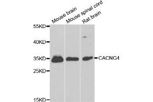 Western blot analysis of extracts of various cell lines, using CACNG4 antibody (ABIN5974747) at 1/1000 dilution. (CACNG4 Antikörper)