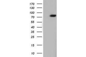 Western Blotting (WB) image for anti-rho GTPase Activating Protein 25 (ARHGAP25) antibody (ABIN1496709) (ARHGAP25 Antikörper)