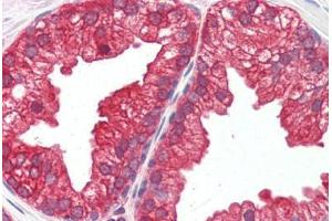 Human Prostate (formalin-fixed, paraffin-embedded) stained with MAP2K1 antibody ABIN461964 at 10 ug/ml followed by biotinylated goat anti-rabbit IgG secondary antibody ABIN481713, alkaline phosphatase-streptavidin and chromogen. (MEK1 Antikörper  (N-Term))