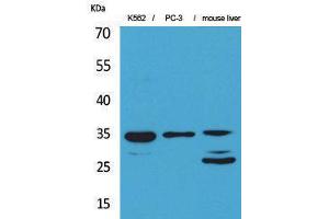 Western Blotting (WB) image for anti-Cell Division Cycle 34 (CDC34) (Internal Region) antibody (ABIN3187727)