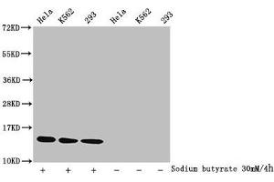 Western Blot Detected samples: Hela whole cell lysate, K562 whole cell lysate, 293 whole cell lysate, Untreated (-) or treated (+) with 30 mM sodium butyrate for 4h All lanes: HIST1H2BC antibody at 1:1000 Secondary Goat polyclonal to rabbit IgG at 1/40000 dilution Predicted band size: 14 kDa Observed band size: 14 kDa (Histone H2B Antikörper  (acLys15))