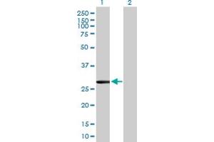 Western Blot analysis of CLIC2 expression in transfected 293T cell line by CLIC2 MaxPab polyclonal antibody. (CLIC2 Antikörper  (AA 1-247))