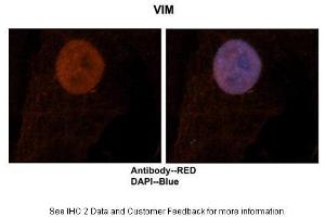 Sample Type :  Human brain stem cells  Primary Antibody Dilution :  1:500  Secondary Antibody :  Goat anti-rabbit Alexa-Fluor 594  Secondary Antibody Dilution :  1:1000  Color/Signal Descriptions :  VIM: Red DAPI:Blue  Gene Name :  VIM  Submitted by :  Dr. (Vimentin Antikörper  (N-Term))