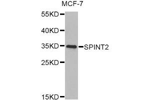 Western blot analysis of extracts of MCF-7 cells, using SPINT2 Antibody. (SPINT2 Antikörper)