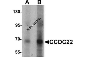 Western Blotting (WB) image for anti-Coiled-Coil Domain Containing 22 (CCDC22) (N-Term) antibody (ABIN1031304) (CCDC22 Antikörper  (N-Term))