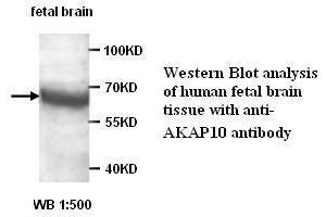 Image no. 1 for anti-A Kinase (PRKA) Anchor Protein 10 (AKAP10) antibody (ABIN1574557) (AKAP10 Antikörper)