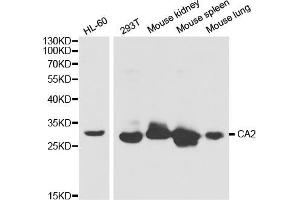 Western blot analysis of extracts of various cell lines, using CA2 antibody (ABIN5970672) at 1/1000 dilution. (CA2 Antikörper)