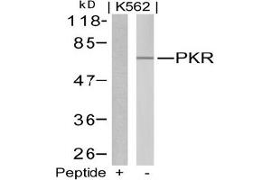 Image no. 1 for anti-Eukaryotic Translation Initiation Factor 2-alpha Kinase 2 (EIF2AK2) (Thr446) antibody (ABIN197544) (EIF2AK2 Antikörper  (Thr446))