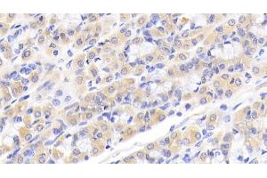 Detection of CALR in Human Stomach Tissue using Polyclonal Antibody to Calreticulin (CALR) (Calreticulin Antikörper  (AA 196-310))