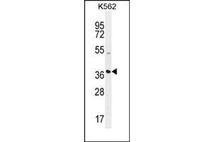 Western blot analysis using SFRP4 Antibody (C-term) Cat. (SFRP4 Antikörper  (C-Term))