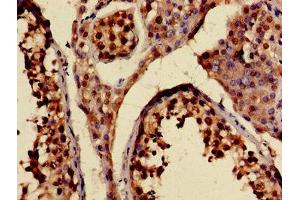 Immunohistochemistry of paraffin-embedded human testis tissue using ABIN7157612 at dilution of 1:100 (KIF2A Antikörper  (AA 161-294))