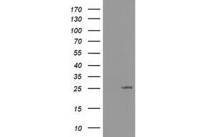Western Blotting (WB) image for anti-Adenylate Kinase 3 (AK3) antibody (ABIN1496522)