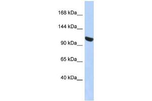 UBA1 antibody used at 1 ug/ml to detect target protein. (UBA1 Antikörper  (N-Term))