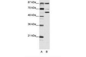 Image no. 1 for anti-K(lysine) Acetyltransferase 2B (KAT2B) (AA 190-239) antibody (ABIN202927) (KAT2B Antikörper  (AA 190-239))