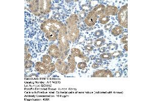 Rabbit Anti-TRNT1 Antibody  Paraffin Embedded Tissue: Human Kidney Cellular Data: Epithelial cells of renal tubule Antibody Concentration: 4.