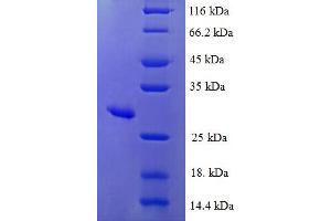 SDS-PAGE (SDS) image for Methionine Sulfoxide Reductase A (MSRA) (AA 24-235) protein (His tag) (ABIN5711905)