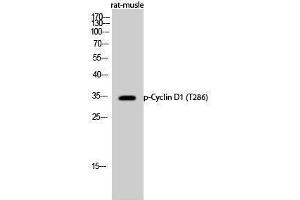 Western Blotting (WB) image for anti-Cyclin D1 (CCND1) (pThr286) antibody (ABIN3172999) (Cyclin D1 Antikörper  (pThr286))