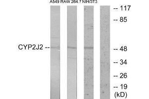 Western Blotting (WB) image for anti-Cytochrome P450, Family 2, Subfamily J, Polypeptide 2 (CYP2J2) (Internal Region) antibody (ABIN1850360) (CYP2J2 Antikörper  (Internal Region))