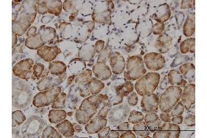 Immunoperoxidase of monoclonal antibody to FBXL18 on formalin-fixed paraffin-embedded human salivary gland.