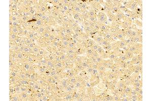 ABIN6263141 and ABIN6273054 at 1/100 staining Rat liver tissue by IHC-P. (MAT1A Antikörper  (N-Term))