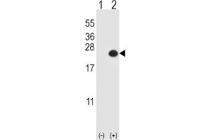 Western Blotting (WB) image for anti-Dual Specificity Phosphatase 3 (DUSP3) antibody (ABIN3003774) (Dual Specificity Phosphatase 3 (DUSP3) Antikörper)