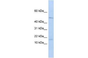 VPREB1 antibody used at 1 ug/ml to detect target protein.